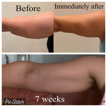 Load image into Gallery viewer, Tighten Sagging Skin Without Surgery — Finally Fix the Neck, Jawline & Arms