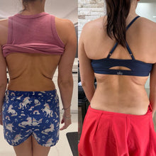 Load image into Gallery viewer, Tighten Sagging Skin Without Surgery — Finally Fix the Neck, Jawline & Arms