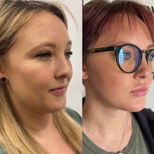 Load image into Gallery viewer, Tighten Sagging Skin Without Surgery — Finally Fix the Neck, Jawline & Arms