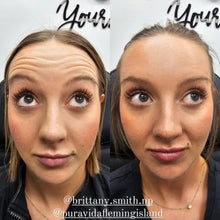 Load image into Gallery viewer, Tox Wrinkle Relaxer