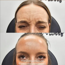 Load image into Gallery viewer, Tox Wrinkle Relaxer
