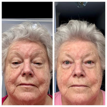 Load image into Gallery viewer, Pro-Xo Exosomes