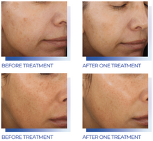 Load image into Gallery viewer, Glacial Facial