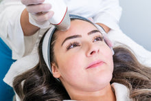 Load image into Gallery viewer, Microneedling – Smooth, Firm & Renew Your Skin