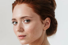 Load image into Gallery viewer, Dark Spot Eliminator- Peel, IPL, Facial