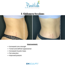 Load image into Gallery viewer, Emsculpt Neo® – Sculpt, Tone & Transform Your Body