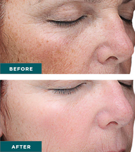 Load image into Gallery viewer, VI Peel- Series of 3