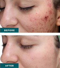 Load image into Gallery viewer, VI Peel- Series of 3