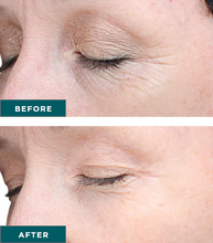 Load image into Gallery viewer, VI Peel- Series of 3