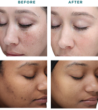 Load image into Gallery viewer, VI Peel- Series of 3