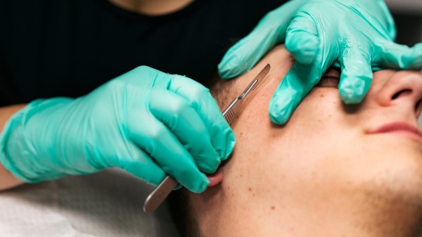 Dermaplaning Rocks!