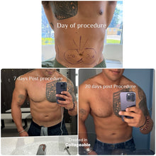 Load image into Gallery viewer, Tighten Sagging Skin Without Surgery — Finally Fix the Neck, Jawline &amp; Arms
