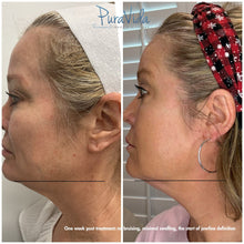 Load image into Gallery viewer, Tighten Sagging Skin Without Surgery — Finally Fix the Neck, Jawline &amp; Arms
