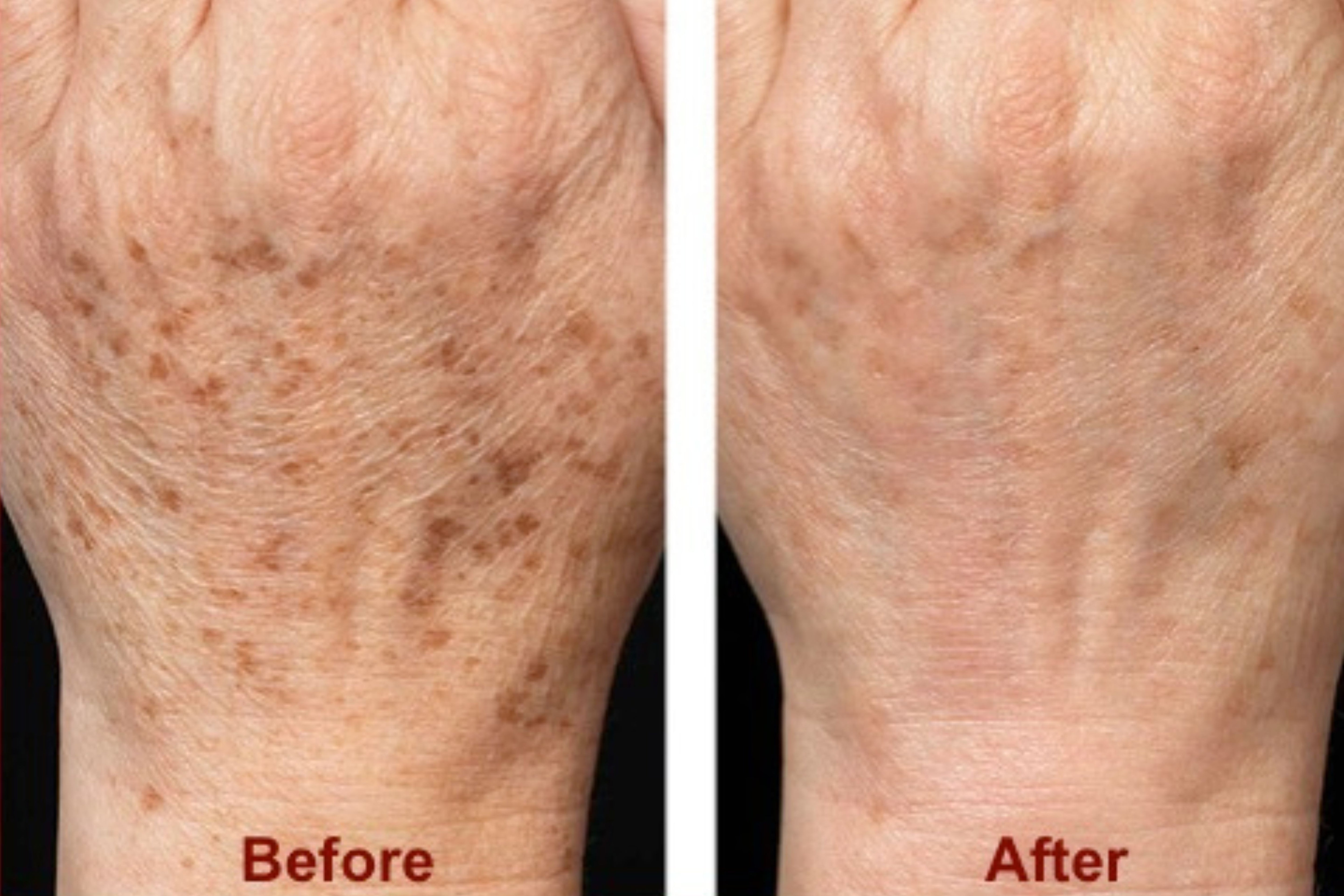 Total Hands Rejuvenation