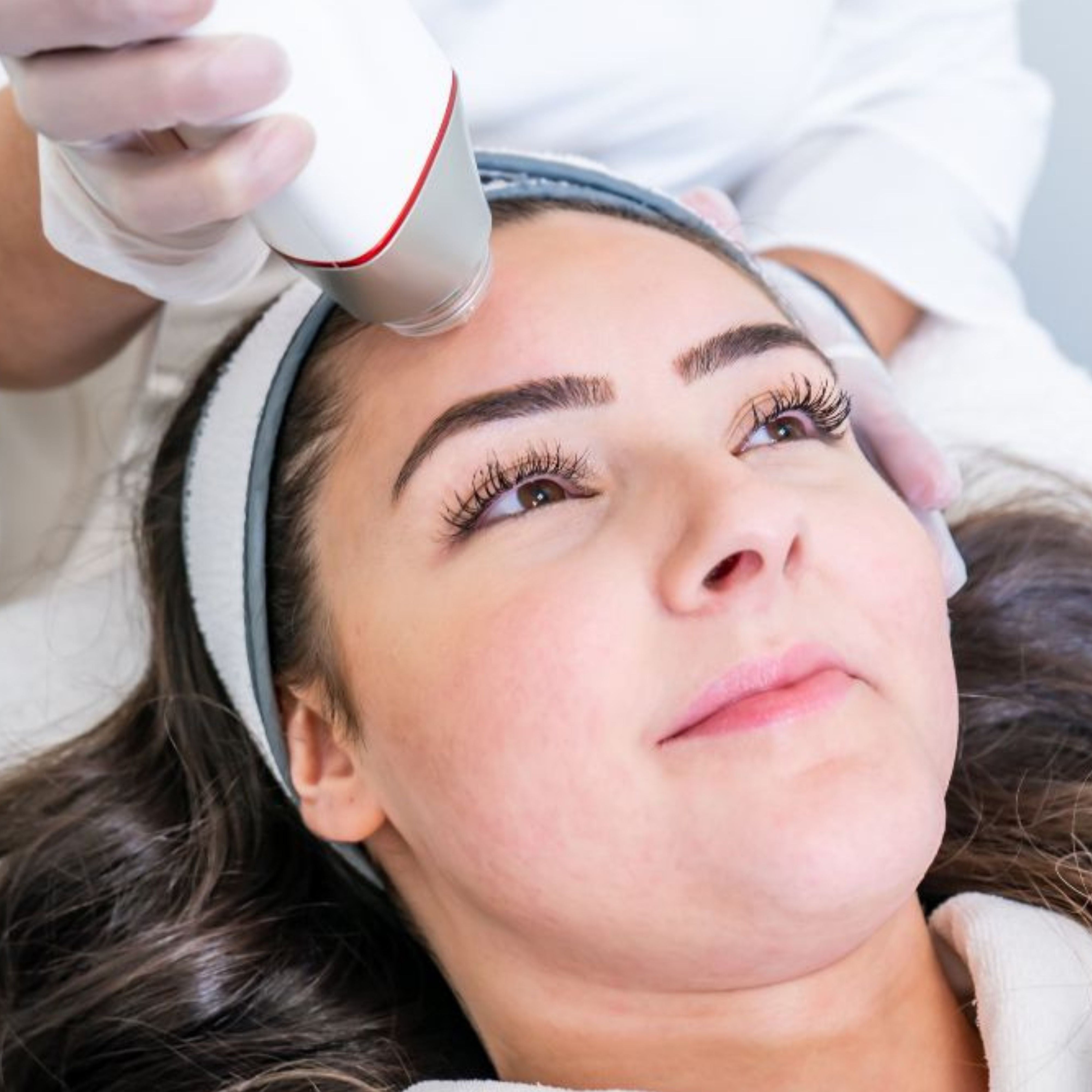 RF Microneedling + 10 FREE Units of Tox with Emily