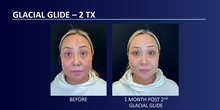 Load image into Gallery viewer, Shaved Ice Facial- 50% OFF
