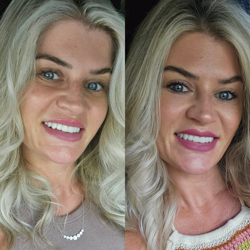 Ariessence PDGF Injectable