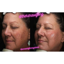 Load image into Gallery viewer, IPL Photofacial – Reveal Your Radiance
