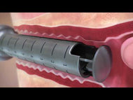 FemTouch Intimate Wellness Series — Buy 2 Get 1