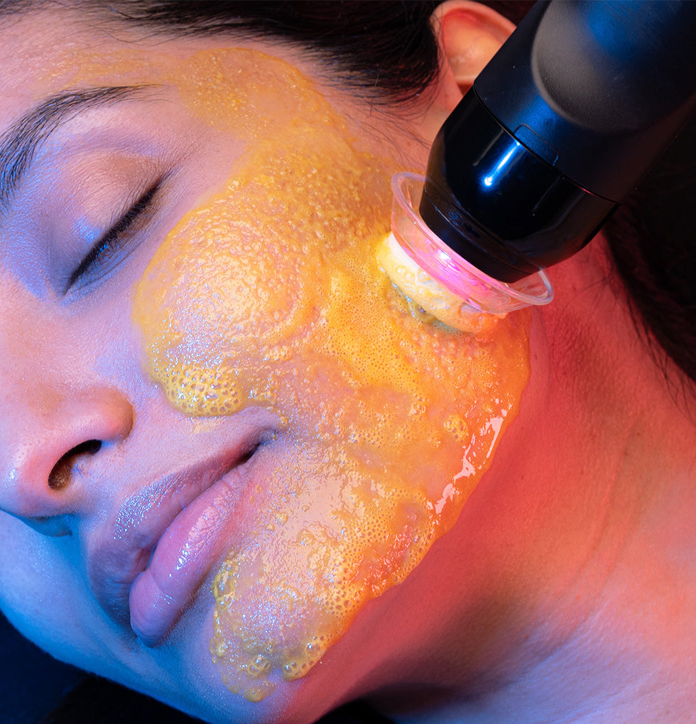 Facial Enhancements
