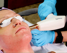 Load image into Gallery viewer, ResurFX (FACE, NECK &amp; CHEST) Skin Resurfacing Duo
