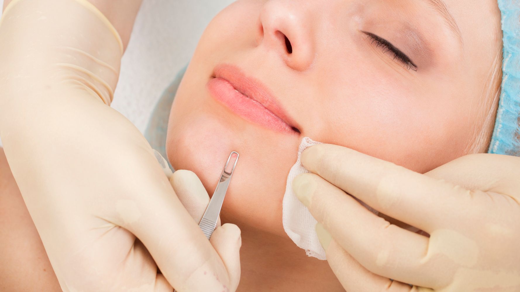 Facial Enhancements