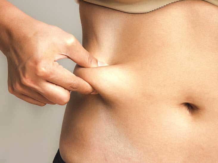 PCDC- Non-surgical Fat Reduction