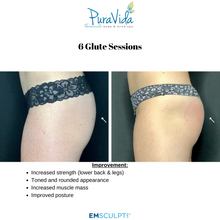 Load image into Gallery viewer, EMSCULPT NEO Body Sculpting Package – 4 Sessions (Any Area) + 2 Bonus Sessions
