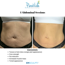 Load image into Gallery viewer, EMSCULPT NEO Body Sculpting Package – 4 Sessions (Any Area) + 2 Bonus Sessions
