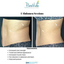 Load image into Gallery viewer, EMSCULPT NEO Body Sculpting Package – 4 Sessions (Any Area) + 2 Bonus Sessions
