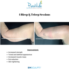 Load image into Gallery viewer, EMSCULPT NEO Body Sculpting Package – 4 Sessions (Any Area) + 2 Bonus Sessions
