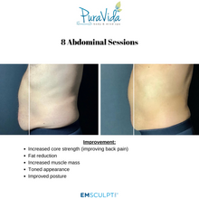 Load image into Gallery viewer, EMSCULPT NEO Body Sculpting Package – 4 Sessions (Any Area) + 2 Bonus Sessions
