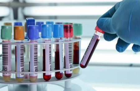 Micronutrient Deficiency Testing